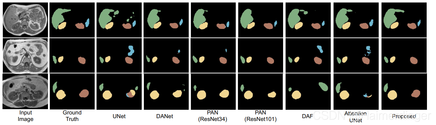 近两年值得阅读的十篇医疗图像分割文献_multi-organ segmentation over partially labeled da ...