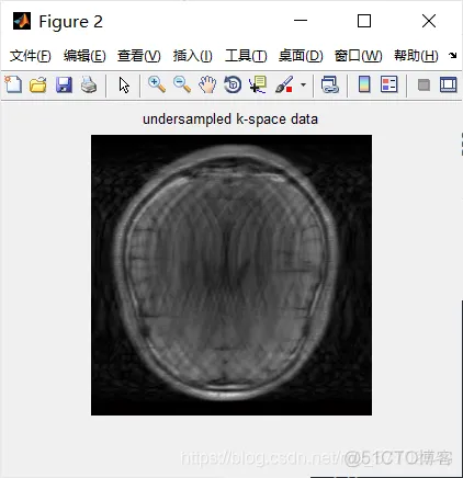 【图像融合】基于平移不变小波变换实现CT图像融合matlab源码_图像处理_08