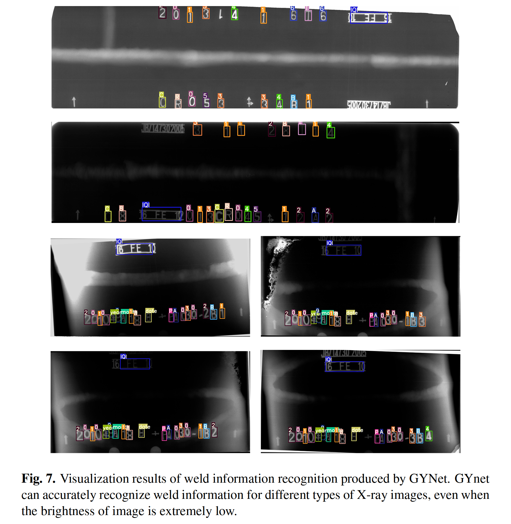 A Lightweight and Accurate Recognition Framework for Signs of X-ray ...