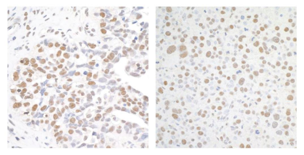 Epicypher热销产品——BRD4 CUTANA™ CUT&RUN Antibody