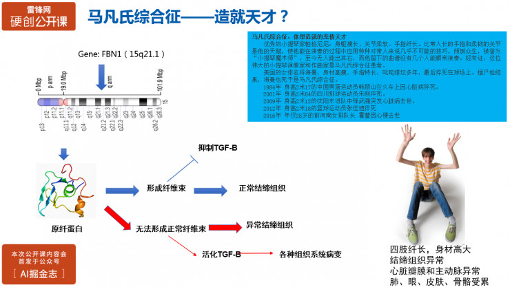 如何利用大数据做遗传病智能化诊断？| 硬创公开课