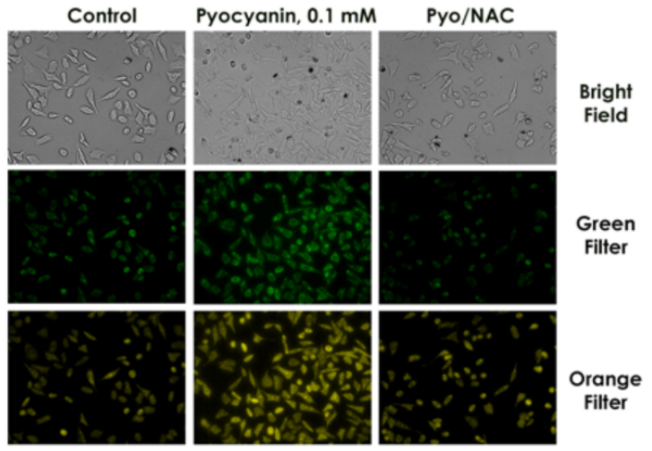 ROS-ID®总活性氧/超氧化物检测试剂盒——ENZO热销产品