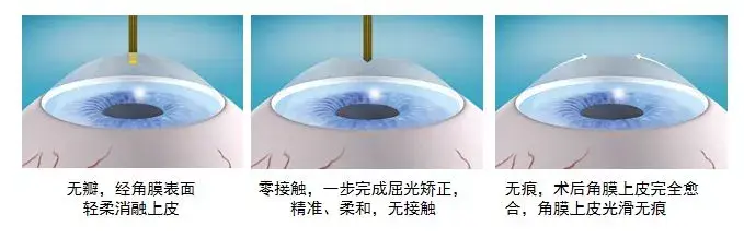 2530112-9be3e8f389a0a05b.png