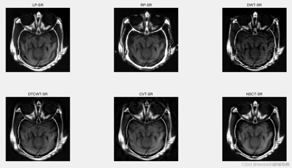 【图像融合】基于nsct-SR+dwt-SR+拉普拉斯金字塔算法-SR等多种图像融合算法matlab_matlab_28