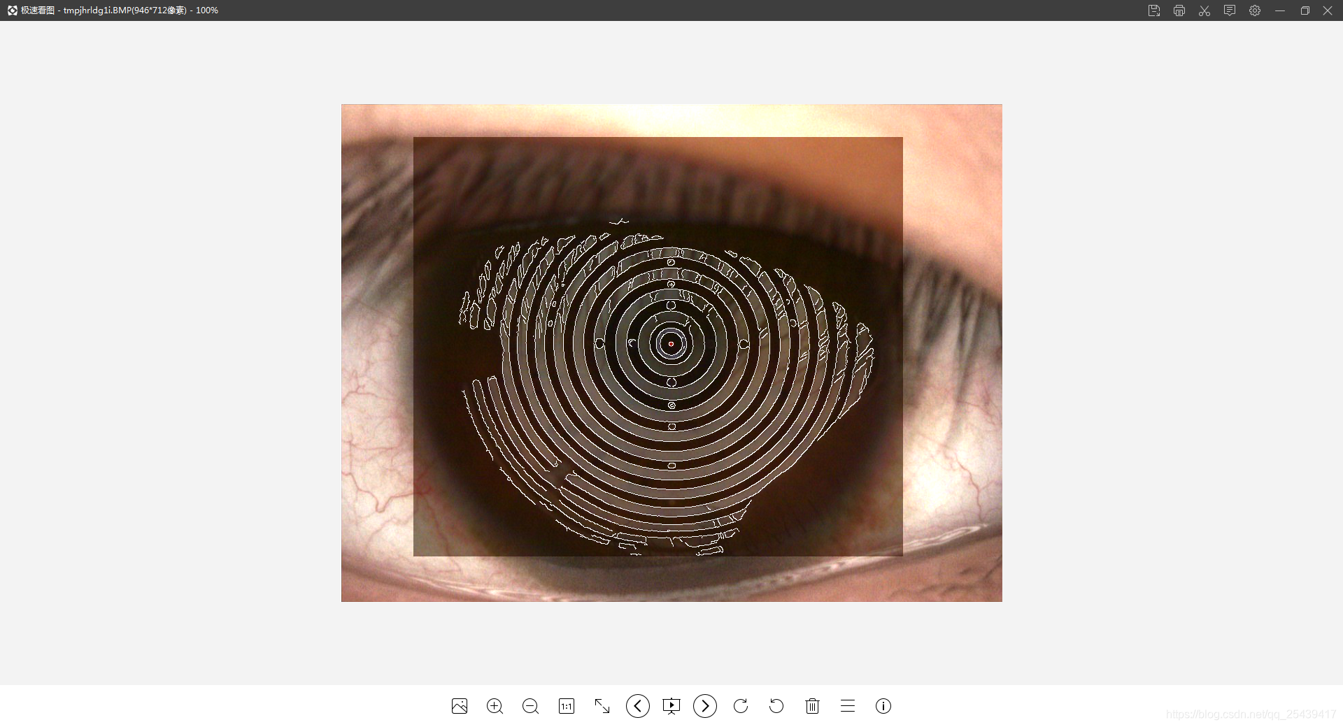 干眼检测 地形图提取 python opencv 图像处理_角膜地形图 代码 github-CSDN博客