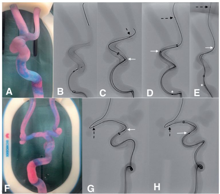 局域网内实现实时语音通话_光学相干断层扫描技术(oct