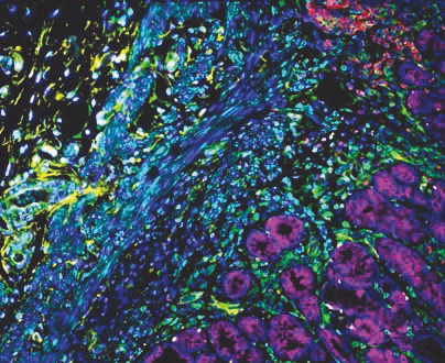 VectaPlex™ Antibody Removal Kit  ——简化您的多重免疫荧光(mIHC)染色