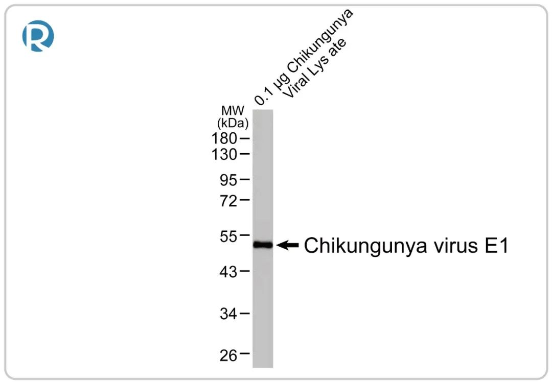 让人痛得只能弯腰行走的基孔肯尼亚病毒