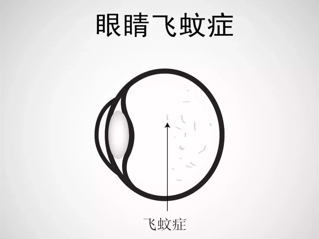 2530112-7913c42465ff1162.png