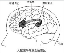 布洛卡区en211
