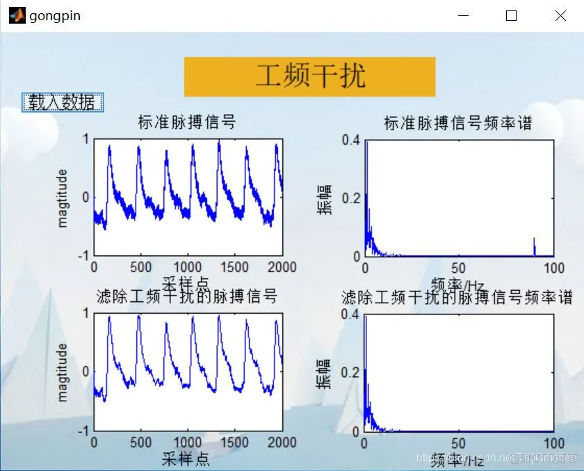 【肌电信号】脉搏信号分析(去噪+特征提取)matlab 源码含GUI_EMG_05