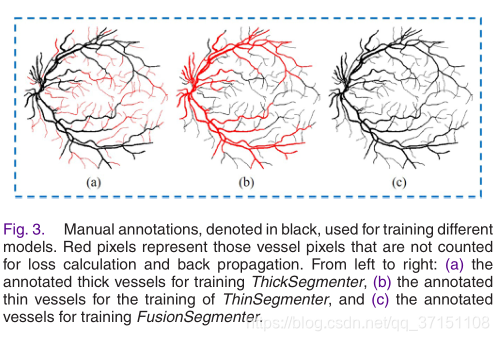 论文阅读——A Three-Stage Deep Learning Model for Accurate Retinal Vessel ...
