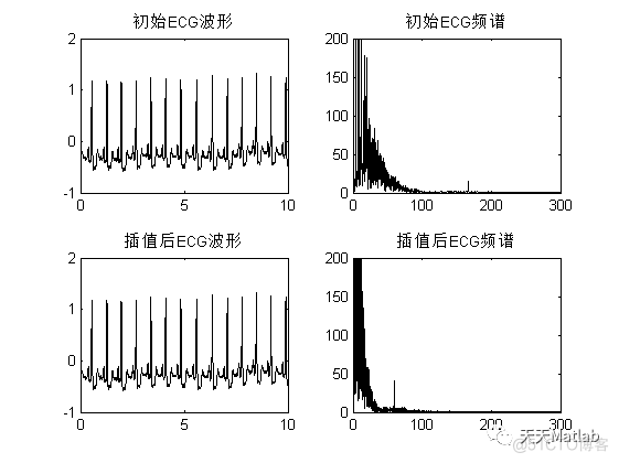 心电图自动诊断系统附GUI界面_方差_03