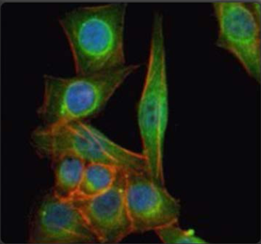 Fitzgerald热销产品——Renin antibody