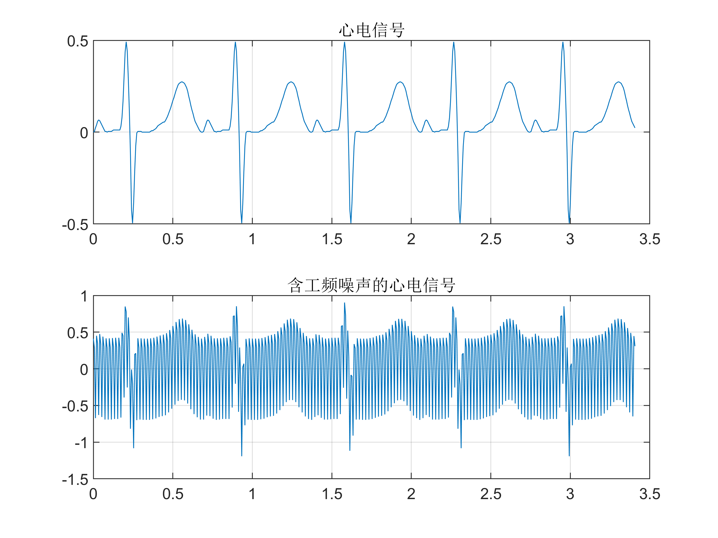 课程设计项目2.1：心电信号中工频干扰估计与消除_心电信号中的工频干扰估计与消除代码-CSDN博客