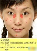 2010030210270532.jpg