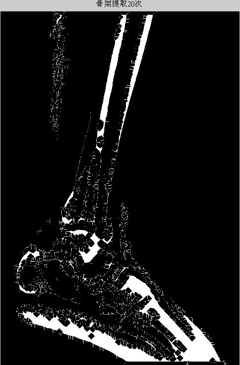 v2-721f04fae4f28fecf0a60067df068f2e_b.jpg
