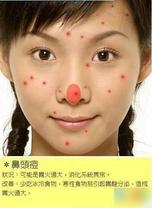 2010030210264265.jpg