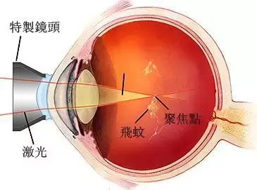 2530112-eead28169d7c7293.png