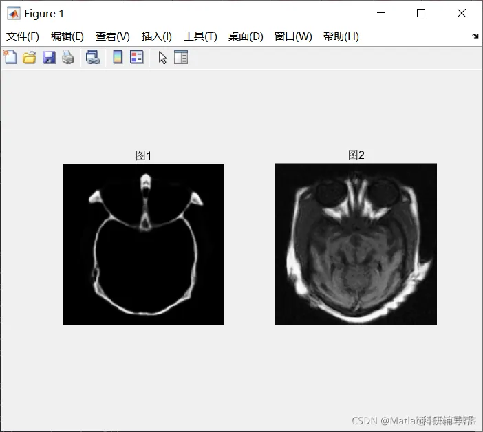 【图像融合】基于nsct-SR+dwt-SR+拉普拉斯金字塔算法-SR等多种图像融合算法matlab_matlab_26