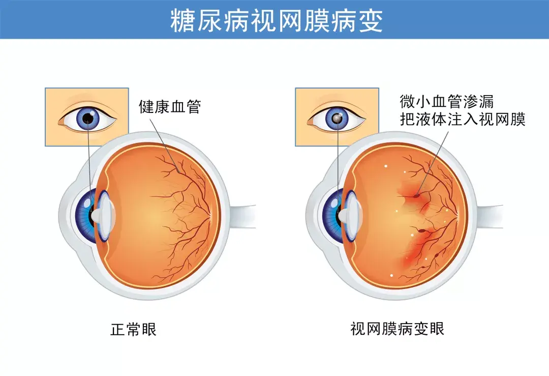 2530112-8953d7f249db06e8.png