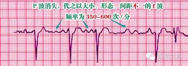 9fe51cb87701f14256b72b4da6c64275.png