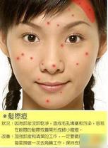 2010030209533647.jpg