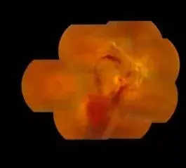 2530112-02371fb2865feb7b.png