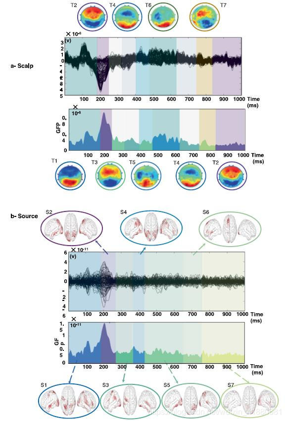 动态脑电图怎么看用于追踪认知任务期间的亚秒级脑动态的高密度脑电_https://www.jmylbn.com_新闻资讯_第11张