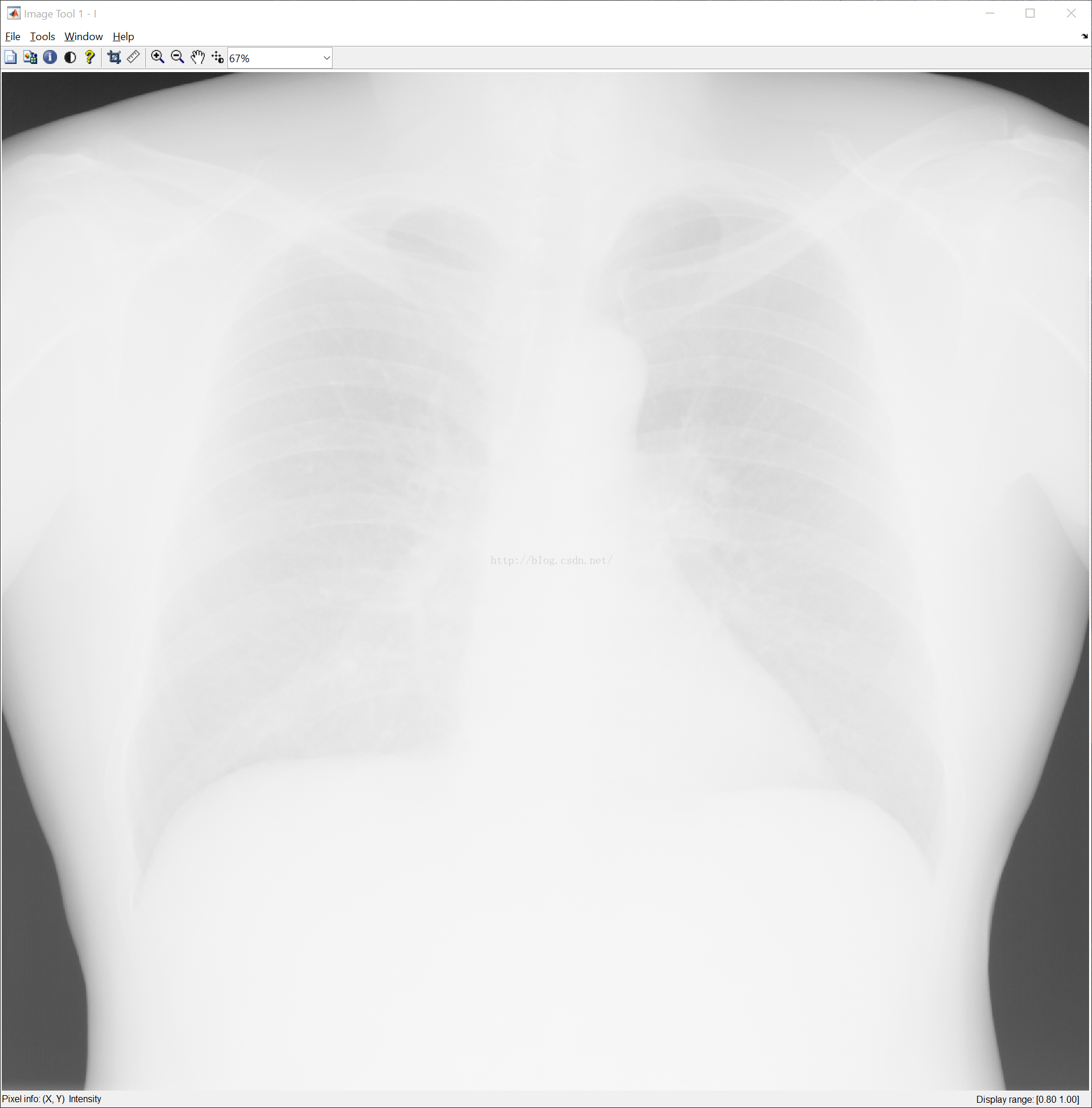82c38c5caf90c6157ed167e6304cfbd9.png