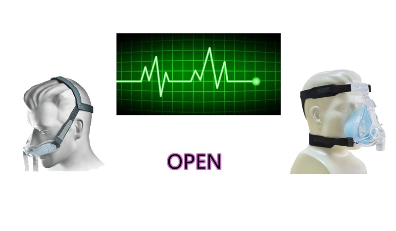 医用呼吸机怎么用uno arduino_医用呼吸机+ STONE LCD + Arduino UNO_https://www.jmylbn.com_新闻资讯_第1张