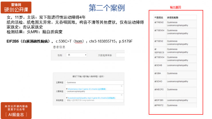 如何利用大数据做遗传病智能化诊断？| 硬创公开课