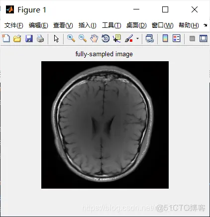 【图像融合】基于平移不变小波变换实现CT图像融合matlab源码_matlab_07