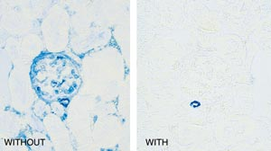 Mouse on Mouse(M.O.M.™)Immunodectection Kits
