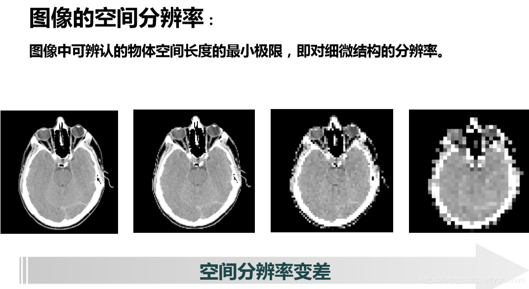 医学图像处理基本流程概念_医学影像图像处理过程包括哪些-CSDN博客