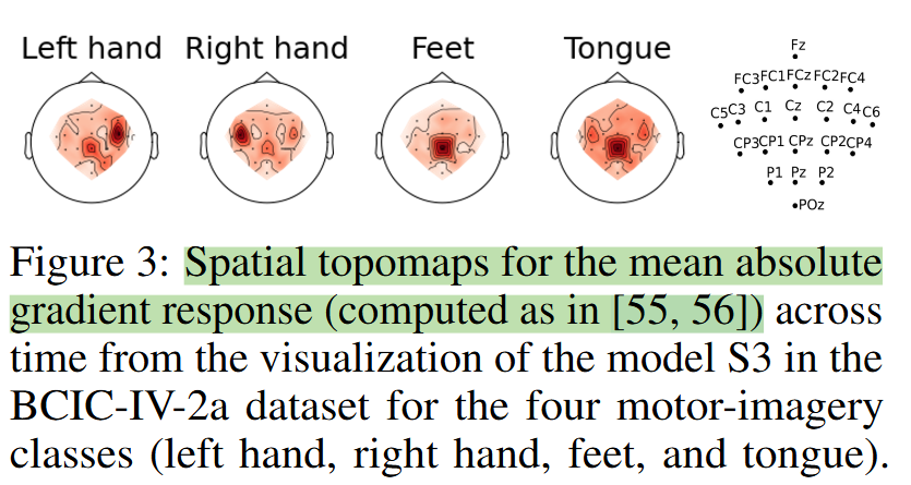 MAtt: A Manifold Attention Network for EEG Decoding阅读笔记_黎曼流形注意力机制-CSDN博客