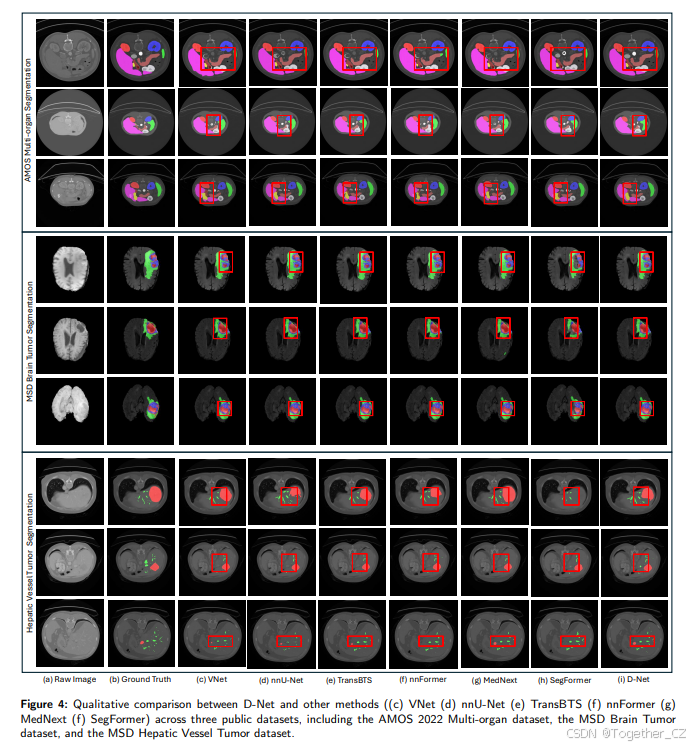 D-Net: Dynamic Large Kernel with Dynamic Feature Fusion for Volumetric ...