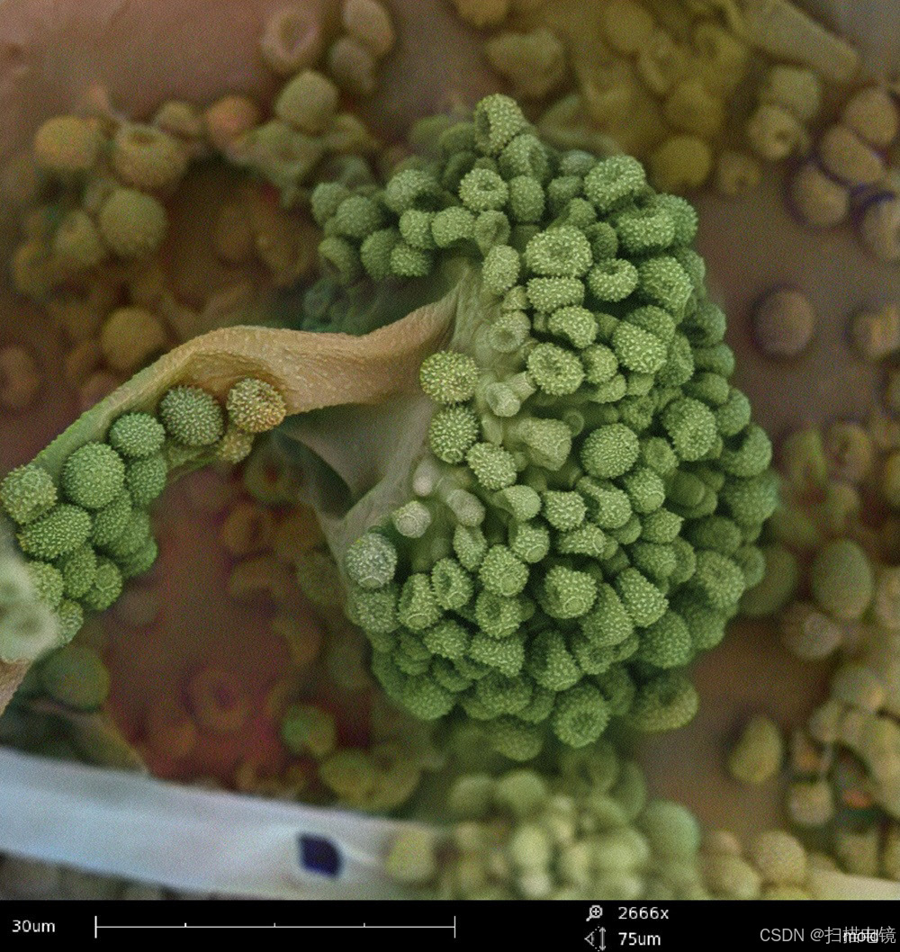 扫描电镜下的微生物-飞纳电镜拍摄
