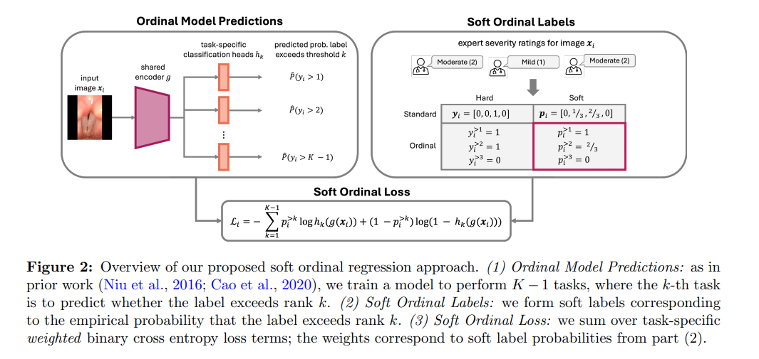 Overview of our proposed soft ordinal regression approach.