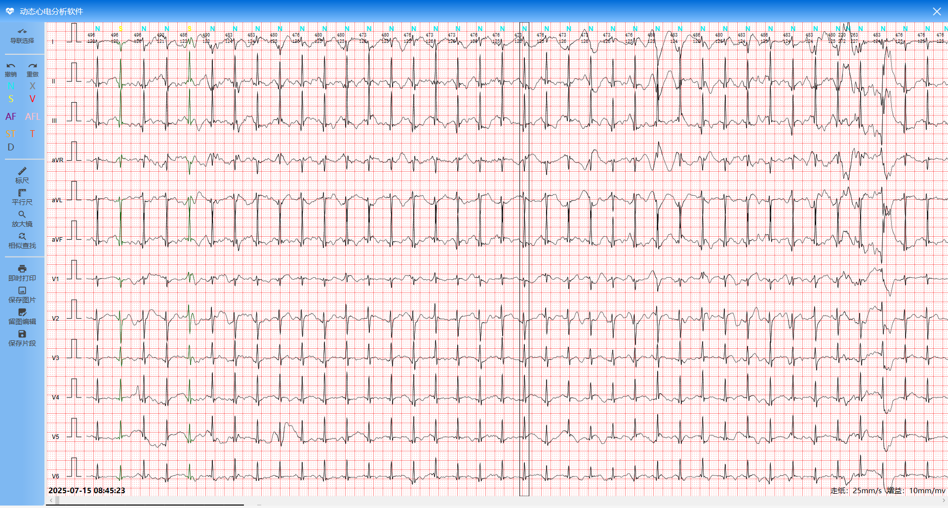 动态心电怎么拆有人做过动态心电分析软件吗？来聊聊实现思路（附图 + 实战路线）_https://www.jmylbn.com_新闻资讯_第1张