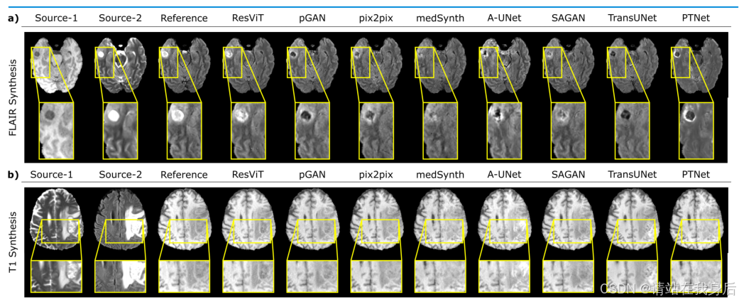 读论文《ResViT: Residual vision transformers for multi-modal medical image ...