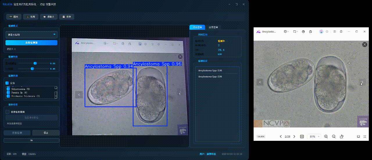 sp管在医学上什么管面向医学检验的YOLO26寄生虫检测系统：钩虫／蛔虫／血吸虫等8种显微图像识别（项目源码+数据集+模型权重+UI界面+python+深度学习+远程环境部署）_https://www.jmylbn.com_新闻资讯_第7张