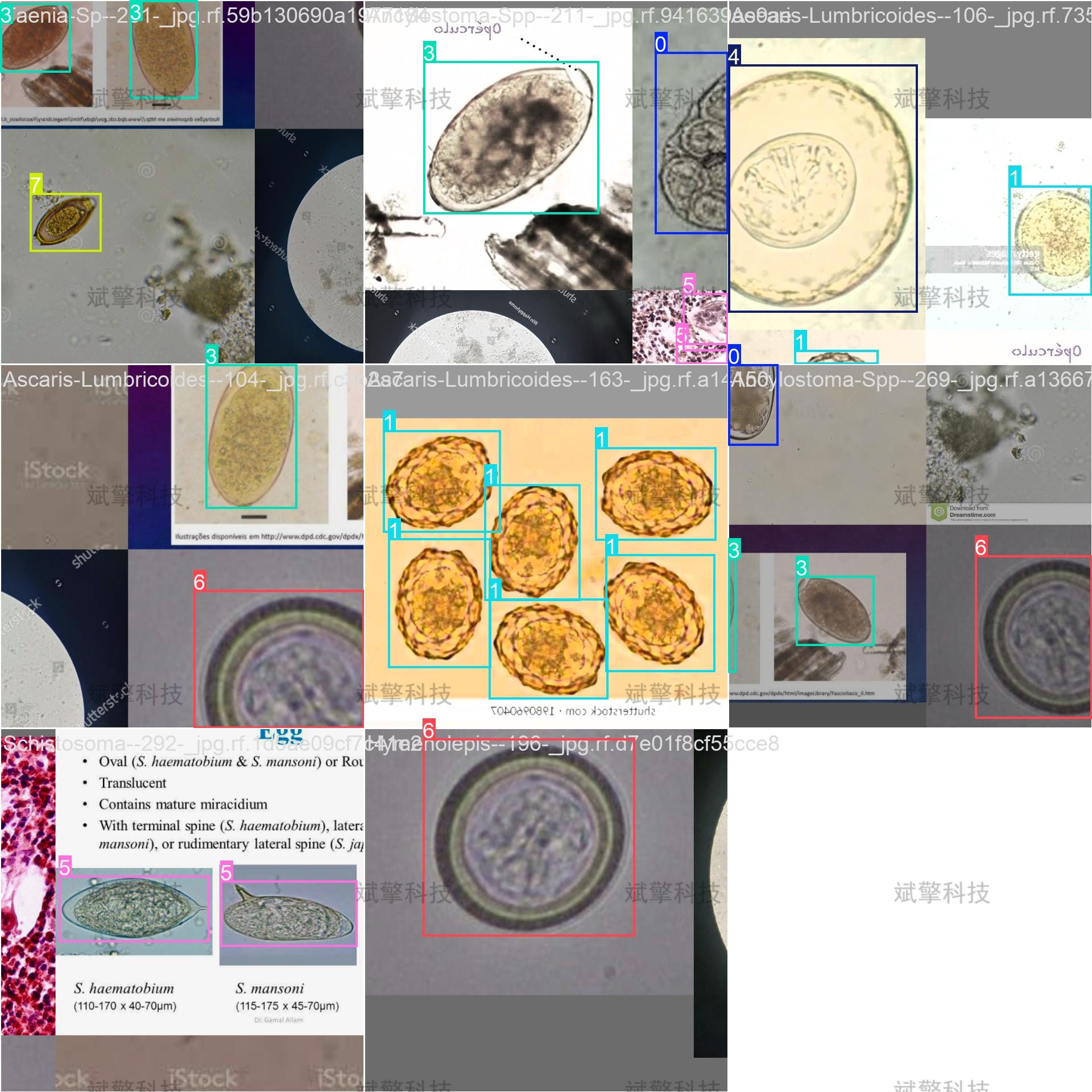 sp管在医学上什么管面向医学检验的YOLO26寄生虫检测系统：钩虫／蛔虫／血吸虫等8种显微图像识别（项目源码+数据集+模型权重+UI界面+python+深度学习+远程环境部署）_https://www.jmylbn.com_新闻资讯_第11张