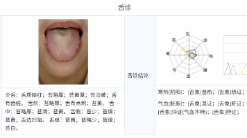 知医邦AI中医智能体在一例中年女性脱发患者的应用封面图