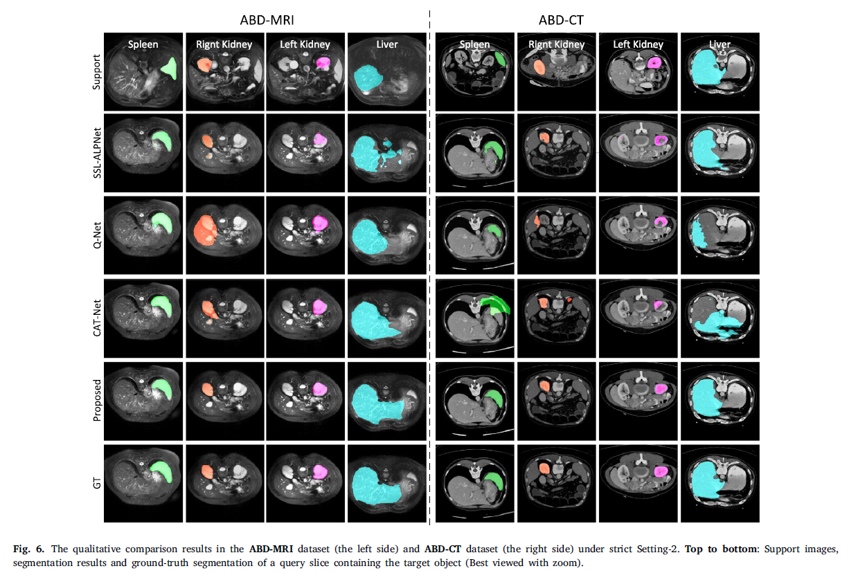 [MIA 2025] Few-shot medical image segmentation with high-fidelity ...