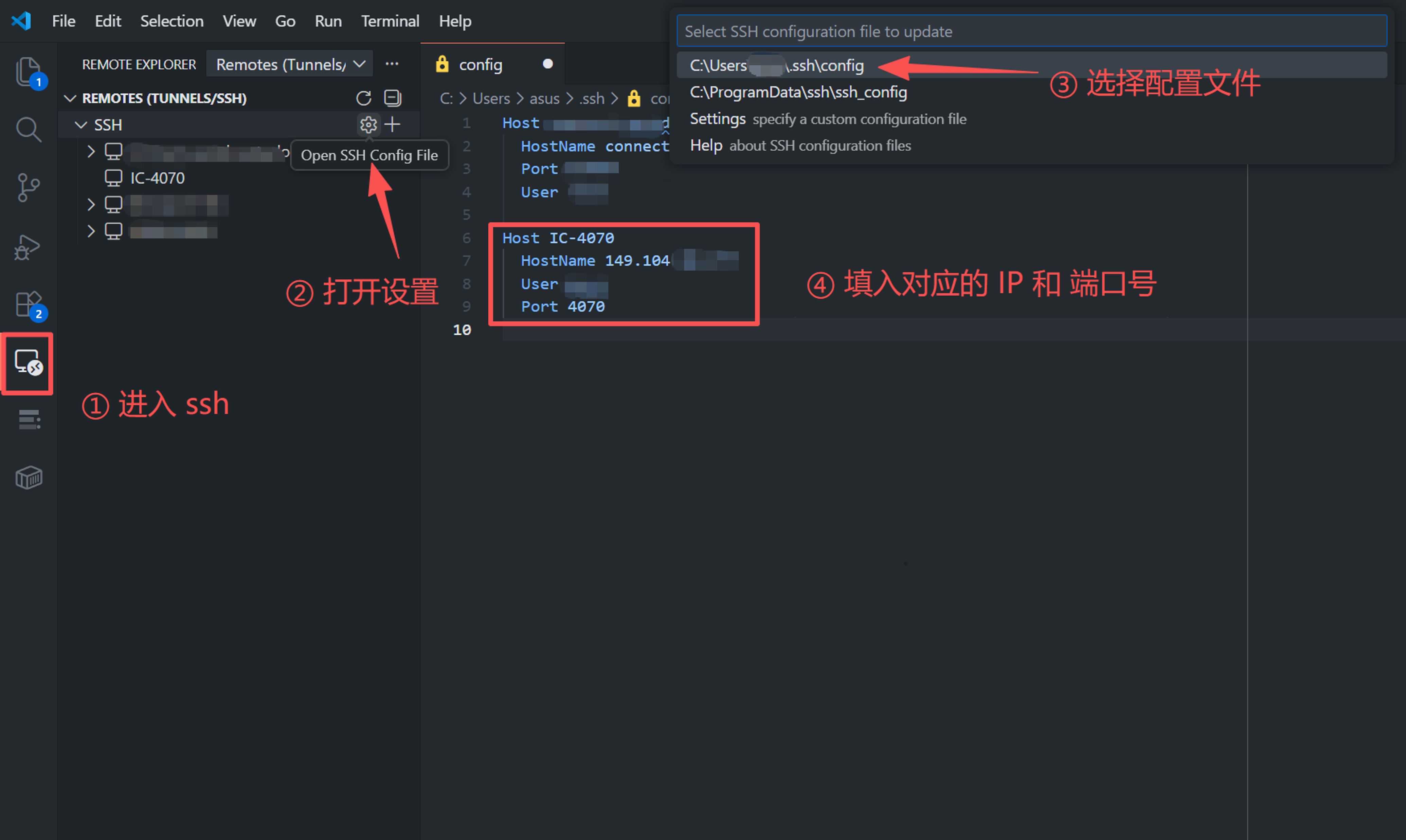 Configuring remote access in VS Code