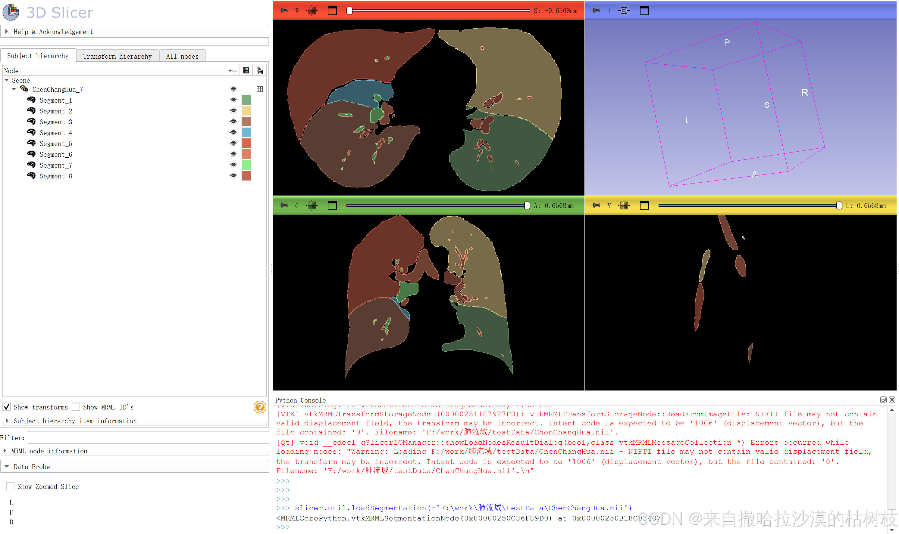 3d slicer python插件制作(二) slicer.util函数方法的试验-CSDN博客