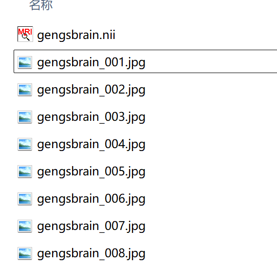 Nii File Python nii文件转jpg,保存在同一文件夹下_nii转jpg-CSDN博客
