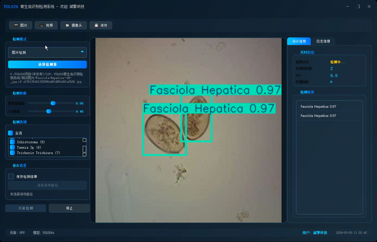 sp管在医学上什么管面向医学检验的YOLO26寄生虫检测系统：钩虫／蛔虫／血吸虫等8种显微图像识别（项目源码+数据集+模型权重+UI界面+python+深度学习+远程环境部署）_https://www.jmylbn.com_新闻资讯_第6张