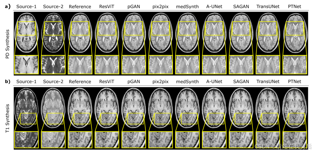 读论文《ResViT: Residual vision transformers for multi-modal medical image ...